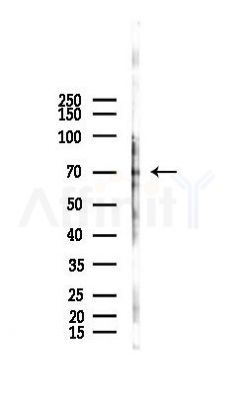 ABCF2 Antibody - Western blot analysis of lysates from Hela cells(LPS,4h treatment), using ABCF2 Antibody at 1/1000 dilution.