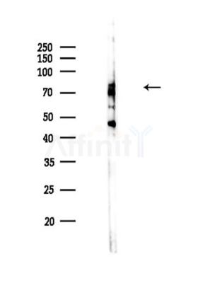 DQX1 Antibody - Western blot analysis of lysates from EC304 cells(LPS,4h treatment), using DQX1 Antibody at 1/1000 dilution.