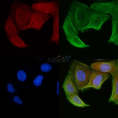 B3GALTL Antibody - DF3835 staining Hela cells(30min of UV treatment) by IF/ICC.