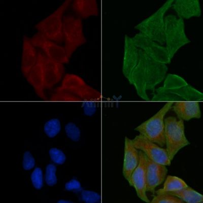 B4GALNT1 Antibody - DF3838 staining Hela cells(30min of UV treatment) by IF/ICC.