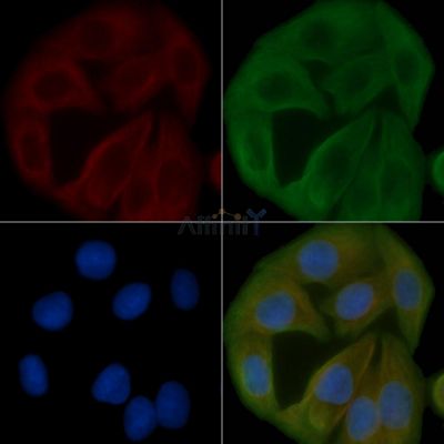 B4GALT3 Antibody - DF3840 staining Hela cells by IF/ICC.