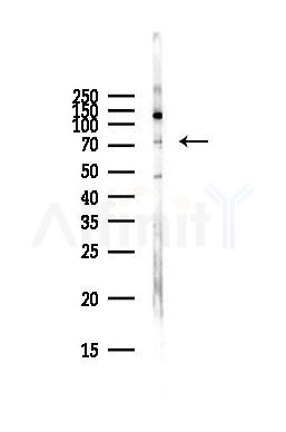 GLB1 Antibody - Western blot analysis of lysates from Hela cells(starvation,24h treatment), using GLB1 Antibody at 1/1000 dilution.