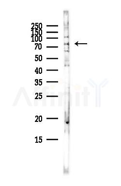 GLB1 Antibody - Western blot analysis of lysates from HepG2 cells(heat-shock,45min treatment), using GLB1 Antibody at 1/1000 dilution.