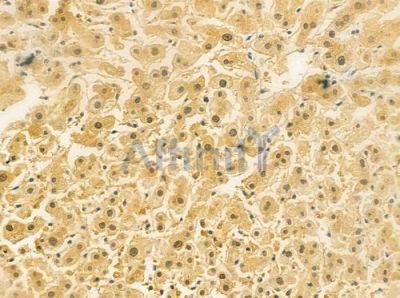 GUSBL1 Antibody - DF3844 at 1/100 staining human normal liver tissue by IHC-P.