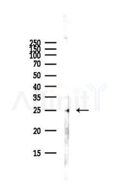 BST2 Antibody - Western blot analysis of lysates from Hela cells(starvation,24h treatment), using BST2 Antibody at 1/1000 dilution.