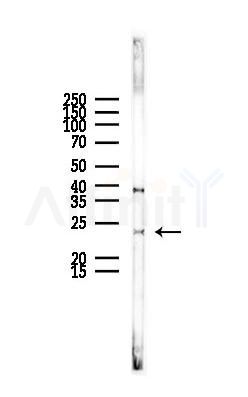 BST2 Antibody - Western blot analysis of lysates from Rat liver, using BST2 Antibody at 1/1000 dilution.