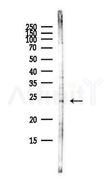 BST2 Antibody - Western blot analysis of lysates from HepG2 cells(heat-shock,45min treatment), using BST2 Antibody at 1/1000 dilution.