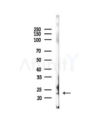 BCAS4 Antibody - Western blot analysis of lysates from HepG2 cells(heat-shock, 45min treatment), using BCAS4 Antibody at 1/1000 dilution.