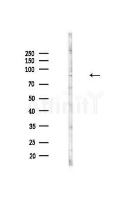 PNPLA8 Antibody - Western blot analysis of lysates from MDA-MB-231 cells(heat-shock,45min treatment), using PNPLA8 Antibody at 1/1000 dilution.