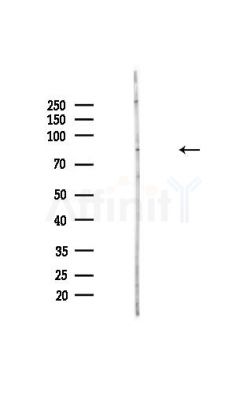 PNPLA8 Antibody - Western blot analysis of lysates from Hela cells(heat-shock,45min treatment), using PNPLA8 Antibody at 1/1000 dilution.