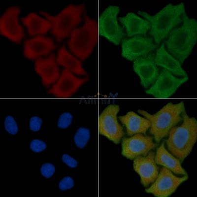 CBR1 Antibody - DF3893 staining Hela cells(45min of heat-shock) by IF/ICC.