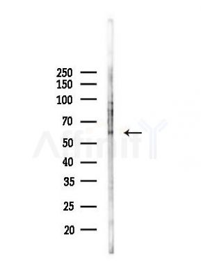 CPN2 Antibody - Western blot analysis of lysates from B16F10-LUC cells(heat-shock,45min treatment), using CPN2 Antibody at 1/1000 dilution.