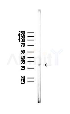 COMT Antibody - Western blot analysis of lysates from Rat liver, using COMT Antibody at 1/1000 dilution.