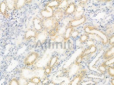 CHSY2 Antibody - DF3940 at 1/100 staining human normal kidney tissue by IHC-P.