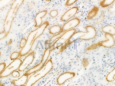 CHSY2 Antibody - DF3940 at 1/100 staining human normal kidney tissue by IHC-P.