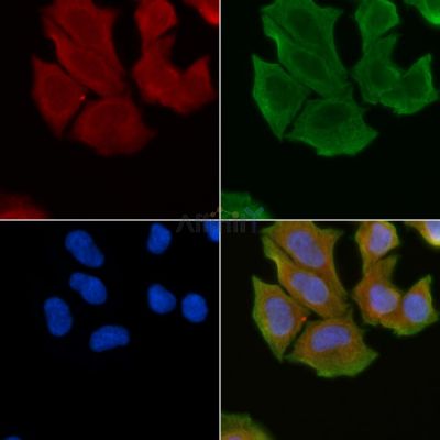 Claudin 6 Antibody - DF3946 staining Hela cells(30min of UV treatment) by IF/ICC.