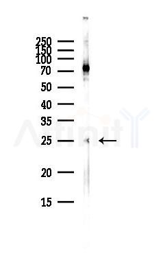 Claudin 8 Antibody - Western blot analysis of lysates from HepG2 cells(heat-shock,45min treatment), using Claudin 8 Antibody at 1/1000 dilution.