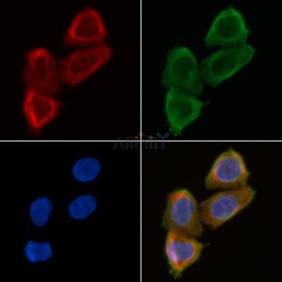BEND4 Antibody - DF3955 staining Hela cells(30min of UV treatment) by IF/ICC.