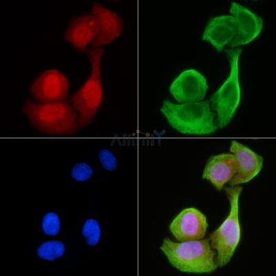 CCDC99 Antibody - DF3957 staining Hela cells(30min of UV treatment) by IF/ICC.