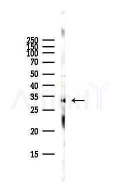 C1QBP Antibody - Western blot analysis of lysates from Hela cells(starvation,24h treatment), using C1QBP Antibody at 1/1000 dilution.