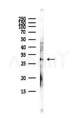 C1QBP Antibody - Western blot analysis of lysates from HepG2 cells(heat-shock,45min treatment), using C1QBP Antibody at 1/1000 dilution.