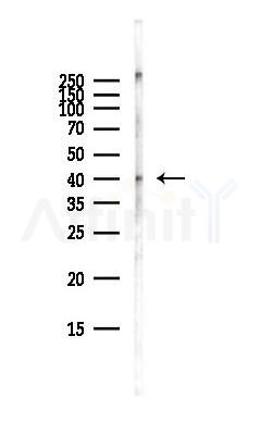 CXADR Antibody - Western blot analysis of lysates from Hela cells(starvation,24h treatment), using CXADR Antibody at 1/1000 dilution.