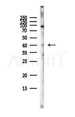 CXADR Antibody - Western blot analysis of lysates from HepG2 cells(heat-shock,45min treatment), using CXADR Antibody at 1/1000 dilution.
