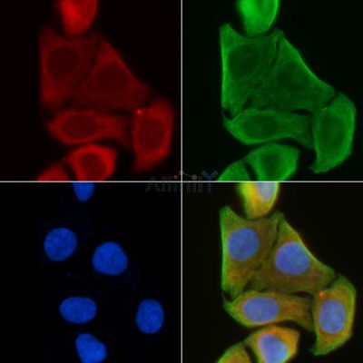 AGBL4 Antibody - DF3981 staining Hela cells(30min of UV treatment) by IF/ICC.