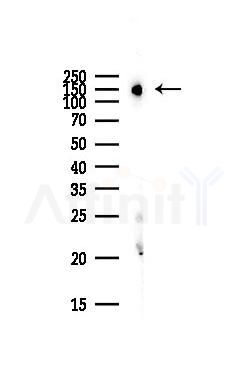 DSG2 Antibody - Western blot analysis of lysates from Hela cells(starvation,24h treatment), using DSG2 Antibody at 1/1000 dilution.