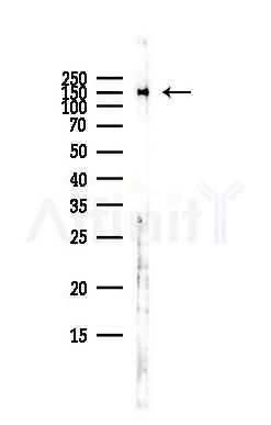 DSG2 Antibody - Western blot analysis of lysates from HepG2 cells(heat-shock,45min treatment), using DSG2 Antibody at 1/1000 dilution.