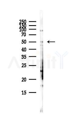 DHODH Antibody - Western blot analysis of lysates from HepG2 cells(heat-shock,45min treatment), using DHODH Antibody at 1/1000 dilution.