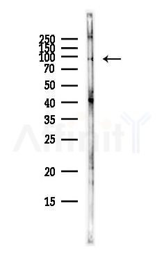 DMGDH Antibody - Western blot analysis of lysates from HepG2 cells(heat-shock,45min treatment), using DMGDH Antibody at 1/1000 dilution.