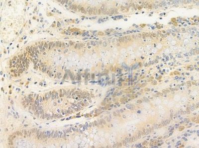 POLD1 Antibody - DF3997 at 1/100 staining human normal colon tissue by IHC-P.