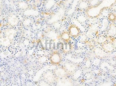 CD3EAP Antibody - DF4002 at 1/100 staining human normal kidney tissue by IHC-P.
