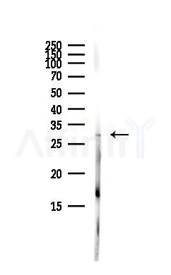 DNAJC5 Antibody - Western blot analysis of lysates from Hela cells(starvation,24h treatment), using DNAJC5 Antibody at 1/1000 dilution.