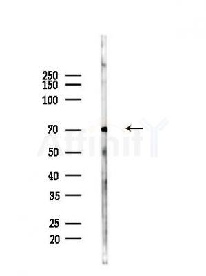 DNAI2 Antibody - Western blot analysis of lysates from Hela cells(heat-shock,45min treatment), using DNAI2 Antibody at 1/1000 dilution.