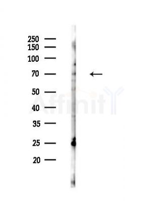 DNAI2 Antibody - Western blot analysis of lysates from Mouse lung, using DNAI2 Antibody at 1/1000 dilution.