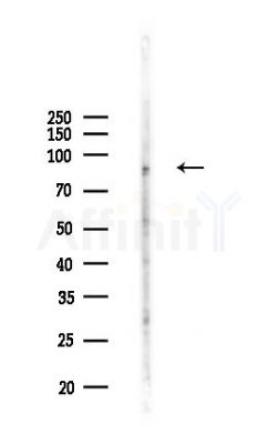 GFM2 Antibody - Western blot analysis of lysates from HepG2 cells(heat-shock,45min treatment), using GFM2 Antibody at 1/1000 dilution.