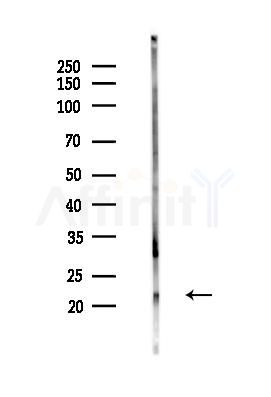 ERD22 Antibody - Western blot analysis of lysates from Mouse testis, using ERD22 Antibody at 1/1000 dilution.