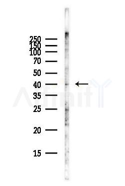 HSD17B2 Antibody - Western blot analysis of lysates from Hela cells(starvation,24h treatment), using HSD17B2 Antibody at 1/1000 dilution.
