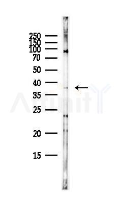 HSD17B2 Antibody - Western blot analysis of lysates from HepG2 cells(heat-shock,45min treatment), using HSD17B2 Antibody at 1/1000 dilution.