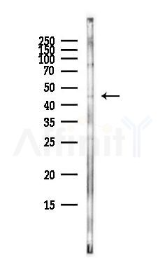 EIF2S2 Antibody - Western blot analysis of lysates from HepG2 cells(heat-shock,45min treatment), using EIF2S2 Antibody at 1/1000 dilution.