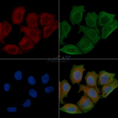 EIF5B Antibody - DF4055 staining Hela cells(45min of heat-shock) by IF/ICC.