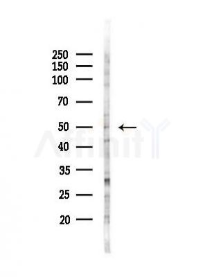 GABRA6 Antibody - Western blot analysis of lysates from EC304 cells(heat-shock,45min treatment), using GABRA6 Antibody at 1/1000 dilution.