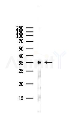 GJA4 Antibody - Western blot analysis of lysates from Hela cells(starvation,24h treatment), using GJA4 Antibody at 1/1000 dilution.