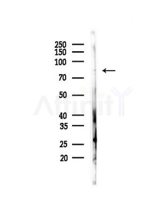 GCF Antibody - Western blot analysis of lysates from HepG2 cells(heat-shock, 45min treatment), using GCF Antibody at 1/1000 dilution.