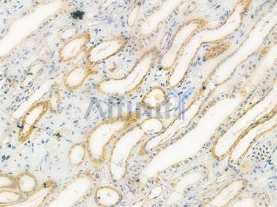 GSTT1 Antibody - DF4087 at 1/100 staining human normal kidney tissue by IHC-P.