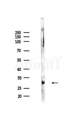 HLA-DOA Antibody - Western blot analysis of lysates from Mouse liver, using HLA-DOA Antibody at 1/1000 dilution.