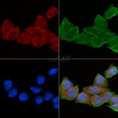 HLA-DOA Antibody - DF4118 staining Hela cells(30min of UV treatment) by IF/ICC.