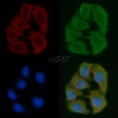 HLA-DOB Antibody - DF4119 staining Hela cells by IF/ICC.